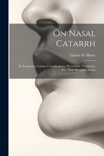 On Nasal Catarrh: Its Symptoms, Causes, Complications, Prevention, Treatment, Etc., With Illustrative Cases