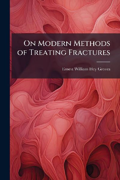 On Modern Methods of Treating Fractures