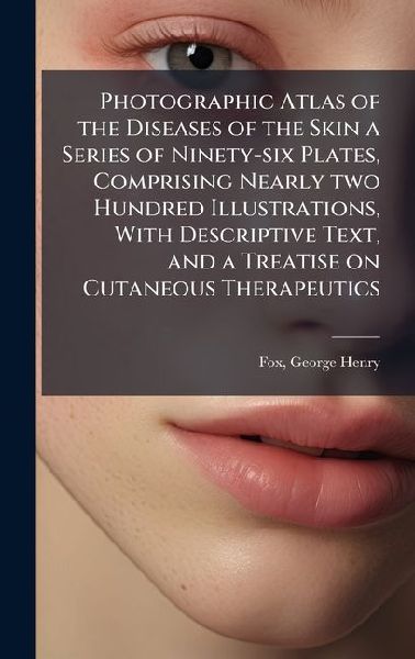 Photographic Atlas of the Diseases of the Skin a Series of Ninety-six Plates, Comprising Nearly two Hundred Illustrations, With Descriptive Text, and a Treatise on Cutaneous Therapeutics