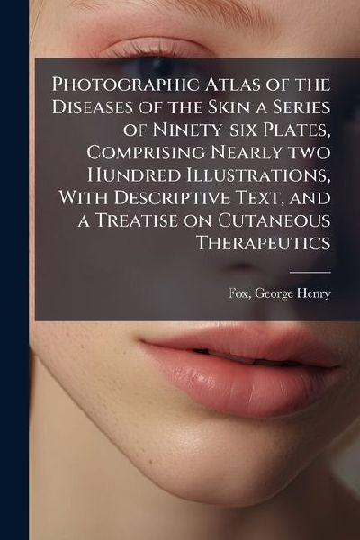 Photographic Atlas of the Diseases of the Skin a Series of Ninety-six Plates, Comprising Nearly two Hundred Illustrations, With Descriptive Text, and a Treatise on Cutaneous Therapeutics