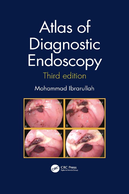 Atlas of Diagnostic Endoscopy, 3E