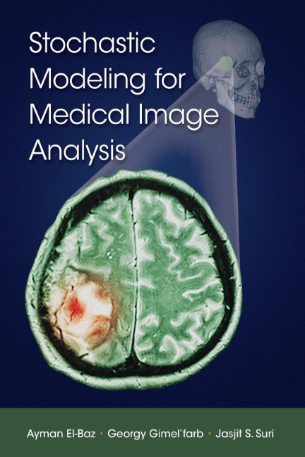 Stochastic Modeling for Medical Image Analysis