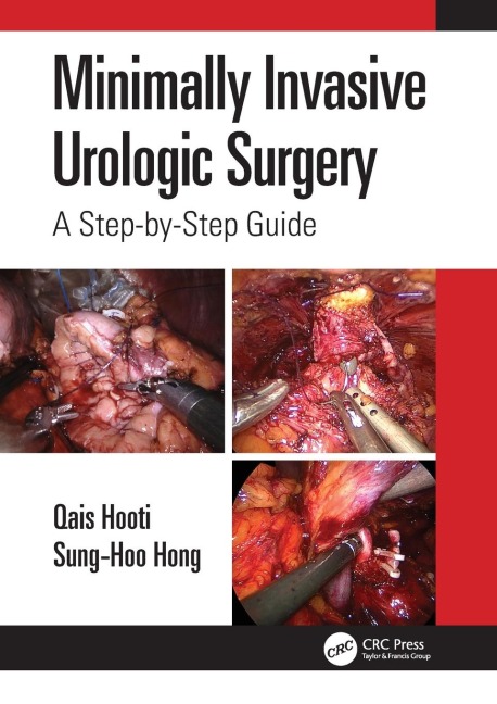 Minimally Invasive Urologic Surgery: A Step-by-Step Guide