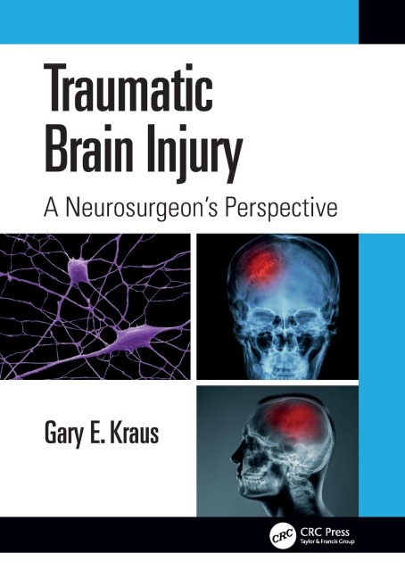 Traumatic Brain Injury: A Neurosurgeons Perspective