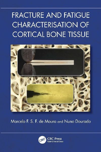 Fracture and Fatigue Characterisation of Cortical Bone Tissue