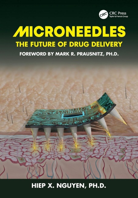 Microneedles: The Future of Drug Delivery