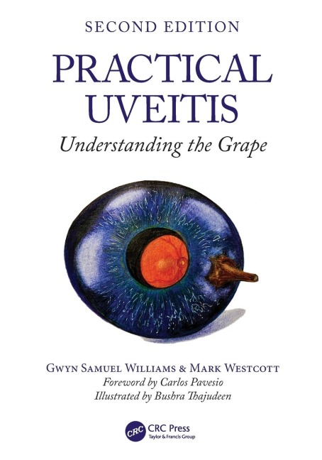 Practical Uveitis: Understanding the Grape