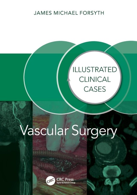 Vascular Surgery:: Illustrated Clinical Cases