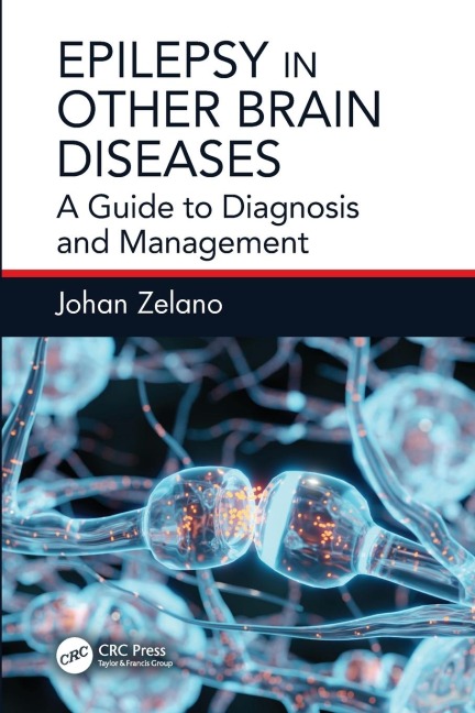 Epilepsy in Other Brain Diseases: A Guide to Diagnosis and Management