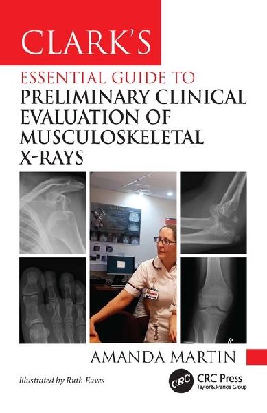 Clarks Essential Guide to Preliminary Clinical Evaluation of Musculoskeletal X-rays
