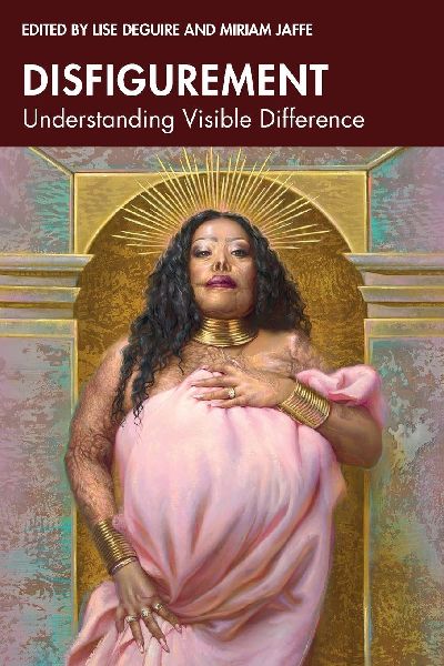 Disfigurement: Understanding Visible Difference