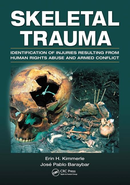 Skeletal Trauma: Identification of Injuries Resulting from Human Rights Abuse and Armed Conflict