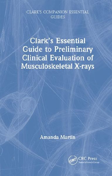 Clark's Essential Guide to Preliminary Clinical Evaluation of Musculoskeletal X-Rays
