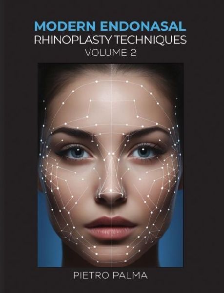 Modern Endonasal Rhinoplasty Techniques - Volume 2