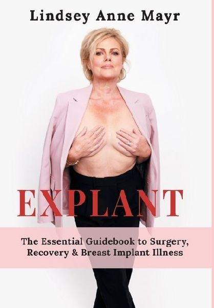 Explant: The Essential Guidebook to Surgery, Recovery & Breast Implant Illness