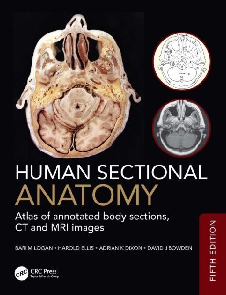 Human Sectional Anatomy: Atlas of annotated body sections, CT and MRI images