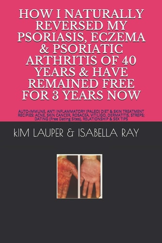 How I Naturally Reversed My Psoriasis, Eczema and Psoriatic Arthritis of 40 Years and Have Remained Free for 3 Years Now AUTO IMMUNE, GLUTEN FREE, DAIRY FREE, PALEO DIET PLAN and SKIN TREATMENT RECIPES: ACNE... RELATIONSHIP (Free Dating Sites) and SEX TIP