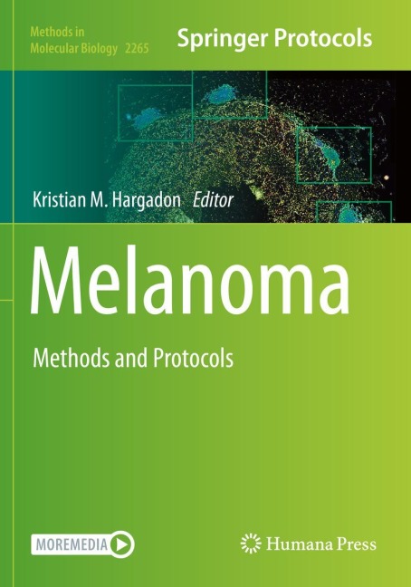 Melanoma: Methods and Protocols