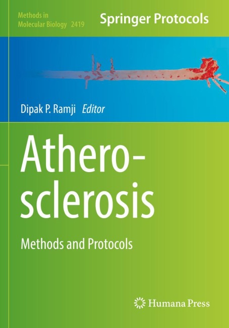 Atherosclerosis: Methods and Protocols