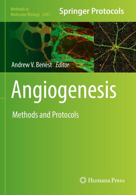 Angiogenesis: Methods and Protocols