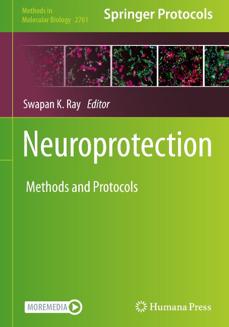 Neuroprotection: Method and Protocols