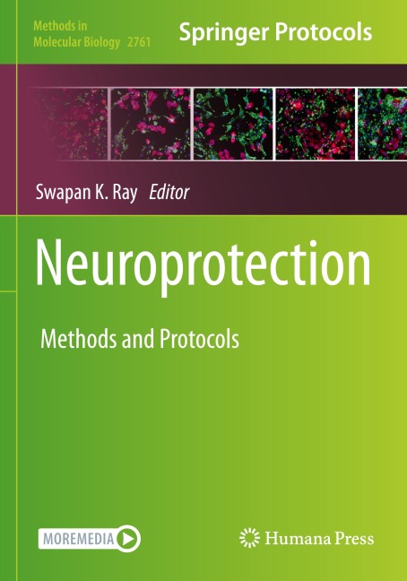 Neuroprotection: Method and Protocols