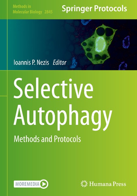 Selective Autophagy: Methods and Protocols