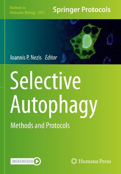 Selective Autophagy: Methods and Protocols