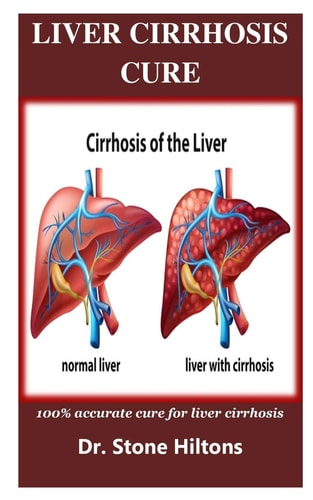 Liver Cirrhosis Cure 100% Accurate Cure for Liver Cirrhosis