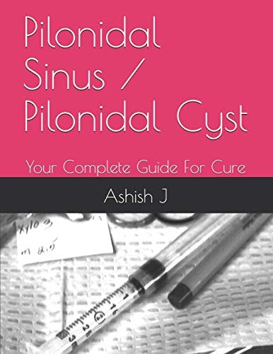 Pilonidal Sinus / Pilonidal Cyst Your Complete Guide For Cure
