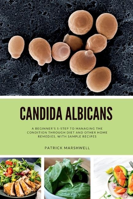 Candida Albicans: A Beginners 5-Step to Managing the Condition Through Diet and Other Home Remedies, With Sample Recipes