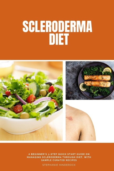 Scleroderma Diet: A Beginners 3-Step Quick Start Guide on Managing Scleroderma Through Diet, With Sample Curated Recipes