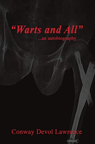 Warts And All An Autobiography