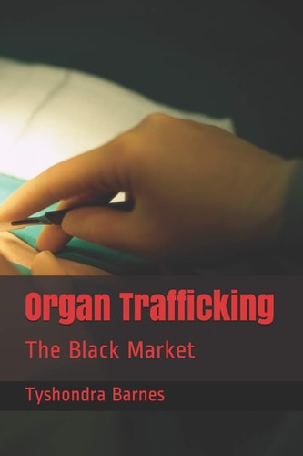 Organ Trafficking The Black Market