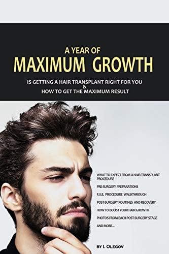 A Year of Maximum Growth Is Getting a Hair Transplant Right for You and How to Get the Maximum Result