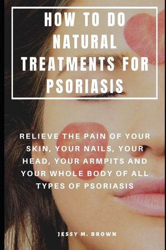 How to Do Natural Treatments for Psoriasis Relieve the Pain of Your Skin, Your Nails, Your Head, Your Armpits and Your Whole Body of All Types of Psoriasis