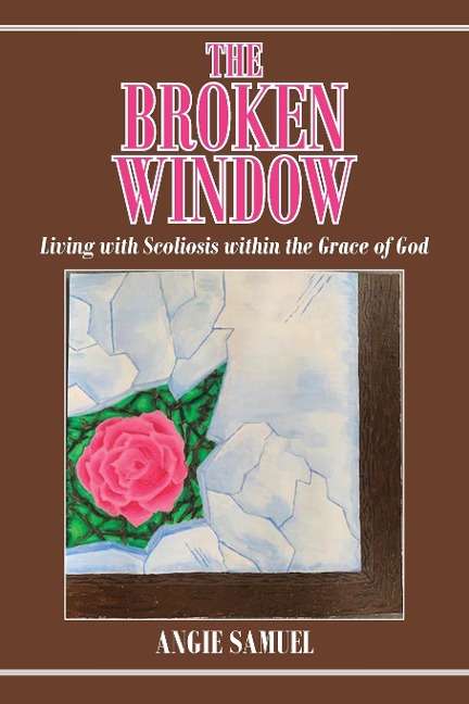 The Broken Window: Living with Scoliosis within the Grace of God