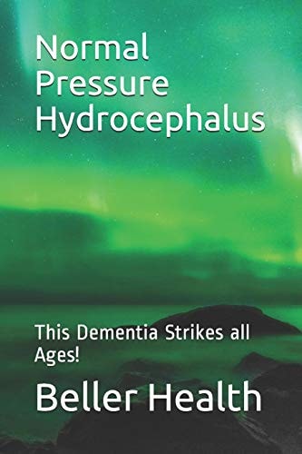 2019 Normal Pressure Hydrocephalus This Dementia Strikes All Ages!