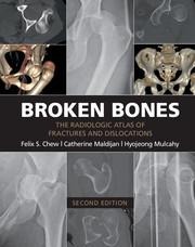Broken Bones: The Radiologic Atlas of Fractures and Dislocations
