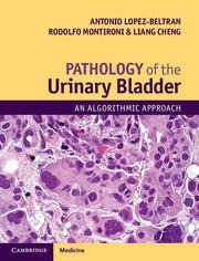 Pathology of the Urinary Bladder: An Algorithmic Approach