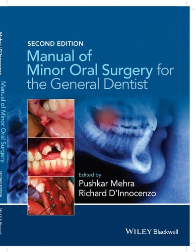 Manual of Minor Oral Surgery for the General Dentist
