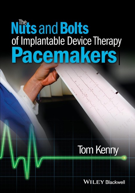 The Nuts and Bolts of Implantable Device Therapy: Pacemakers