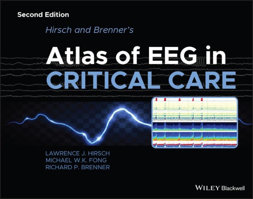 Hirsch and Brenners Atlas of EEG in Critical Care