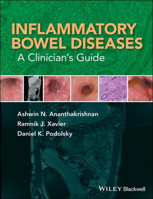 Inflammatory Bowel Diseases: A Clinician's Guide