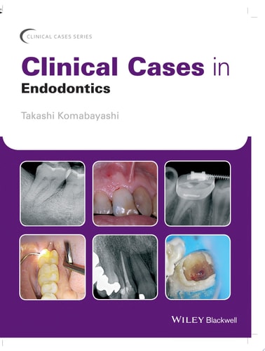 Clinical Cases in Endodontics