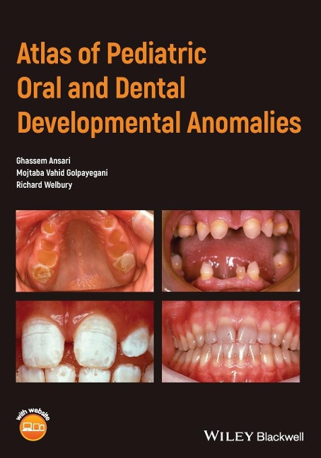 Atlas of Pediatric Oral and Dental Developmental Anomalies