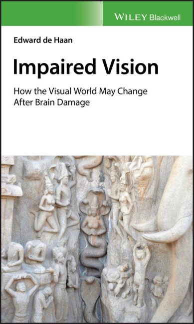 Impaired Vision: How the Visual World May Change After Brain Damage