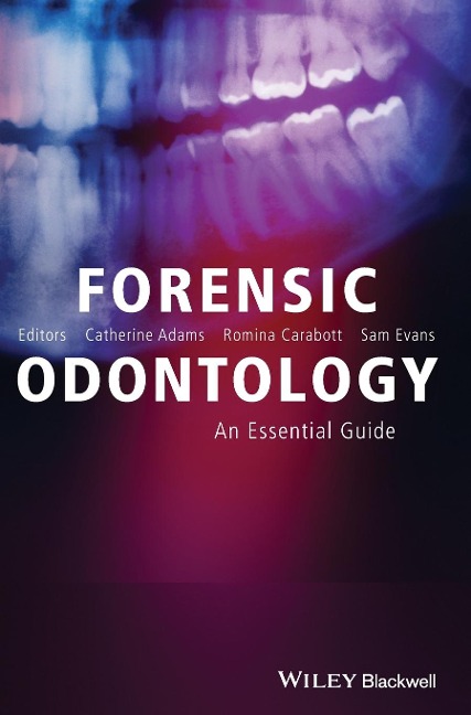 Forensic Odontology: An Essential Guide