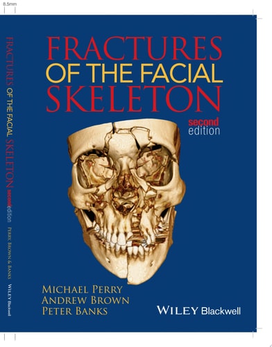 Fractures of the Facial Skeleton