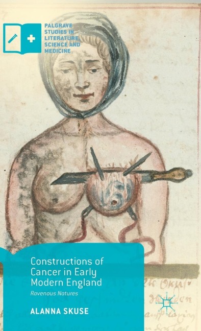 Constructions of Cancer in Early Modern England: Ravenous Natures